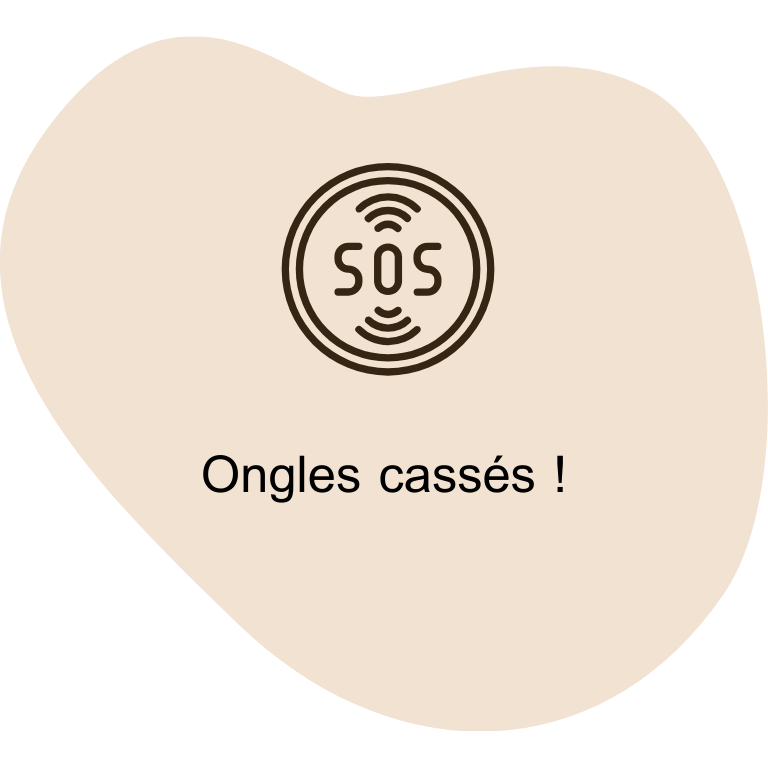réparation d'ongles cassés par lm beauty, spécialiste des ongles à Valenciennes